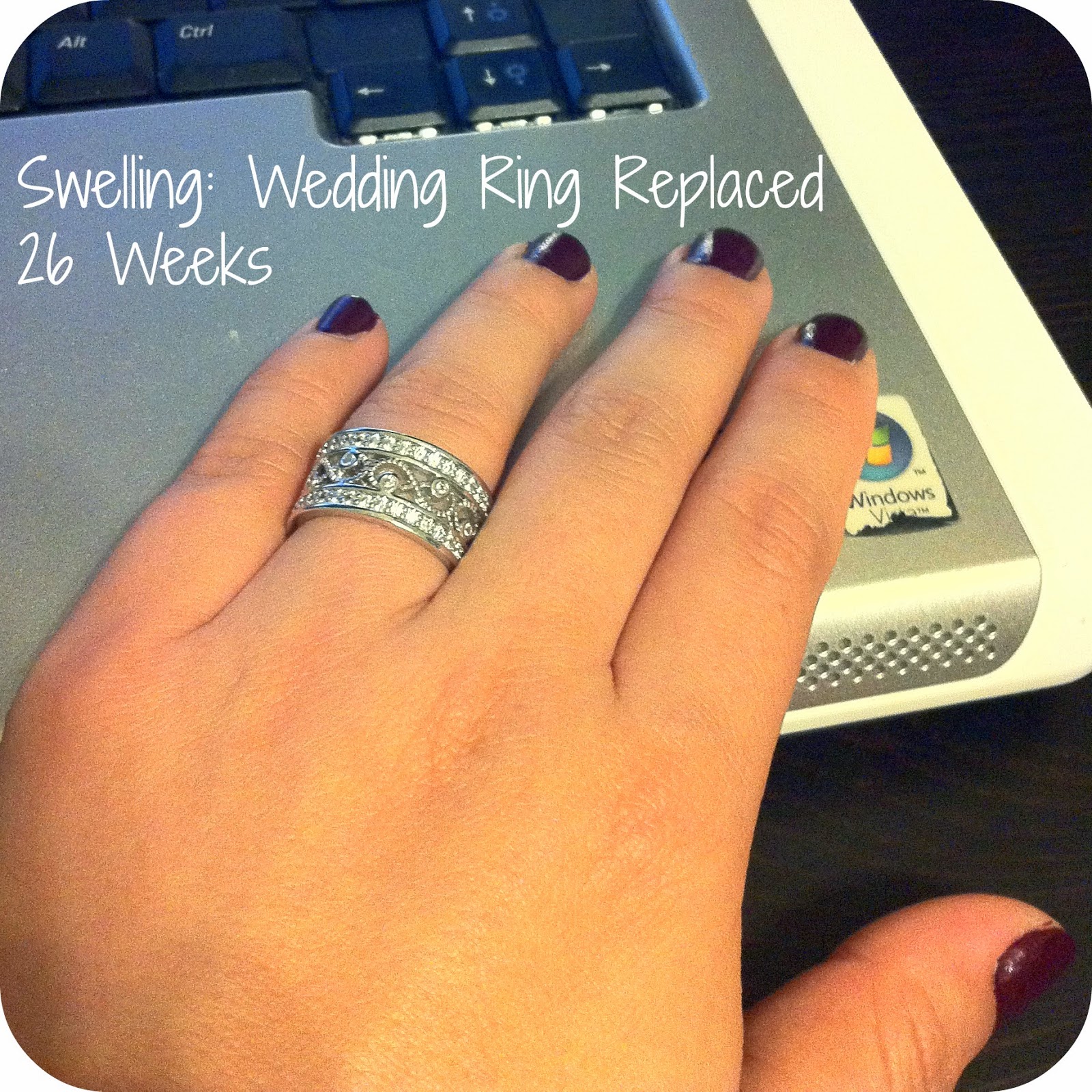 pregnancyswellingweddingring Seven Graces